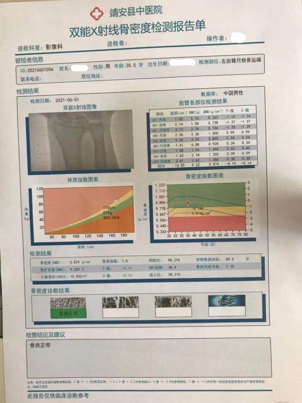 江西省靖安縣中醫(yī)院引進品源雙能X射線骨密度儀